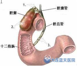 十二指腸潰瘍的致病因